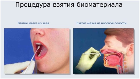 biomaterial