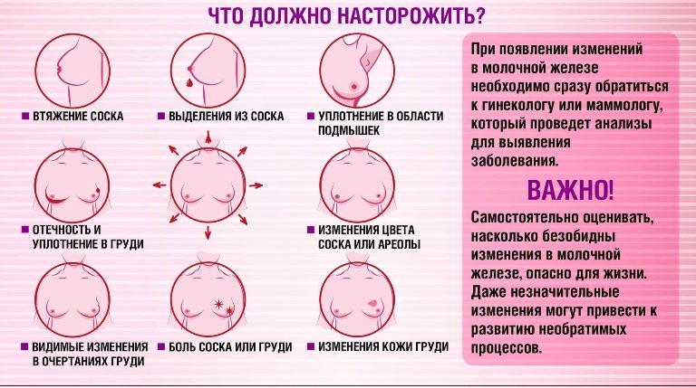 borba s rakom grudi info