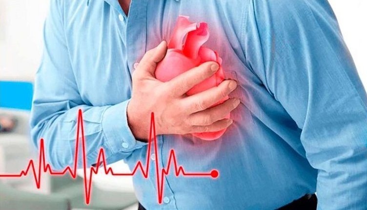 infarct glav