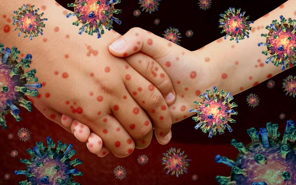 enterovirus1
